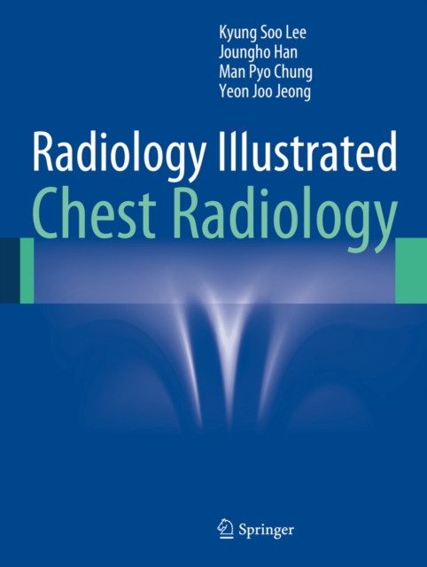 Radiology Illustrated: Chest Radiology, PDF eBook