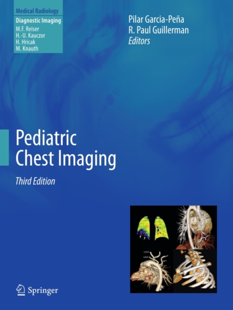 Pediatric Chest Imaging, PDF eBook