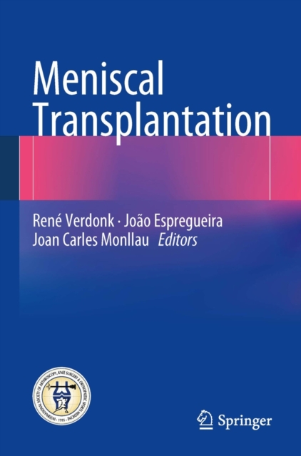 Meniscal Transplantation, Paperback / softback Book