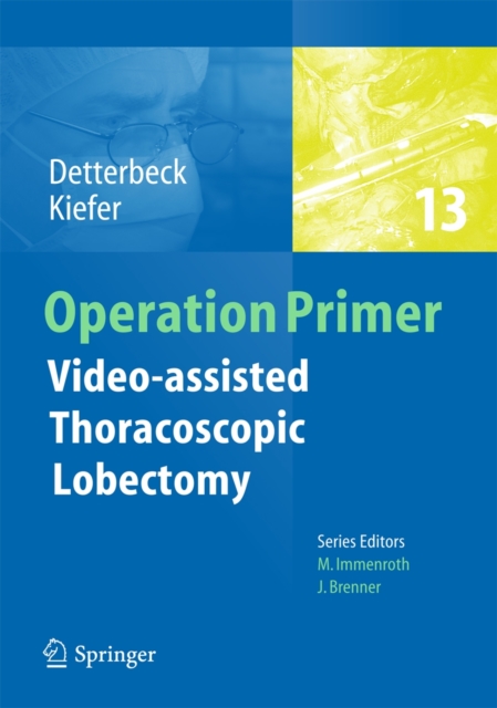 Video - assisted Thoracoscopic Lobectomy, Paperback / softback Book
