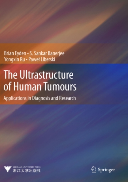 The Ultrastructure of Human Tumours : Applications in Diagnosis and Research, PDF eBook