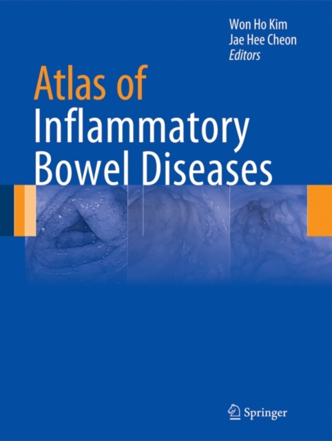 Atlas of Inflammatory Bowel Diseases, Hardback Book