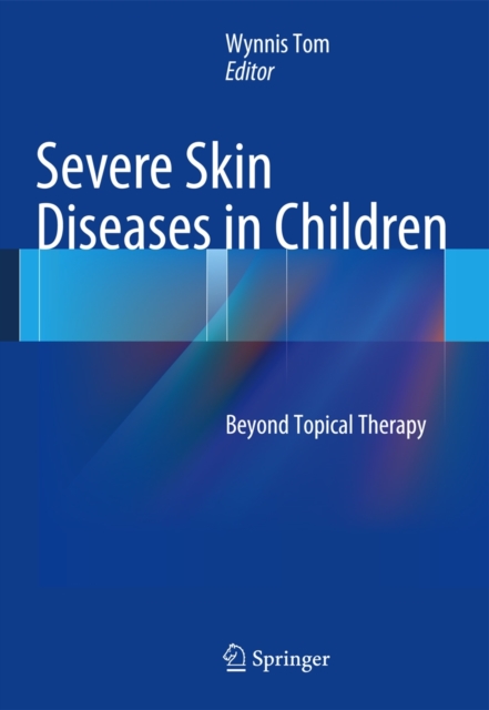 Severe Skin Diseases in Children : Beyond Topical Therapy, Hardback Book