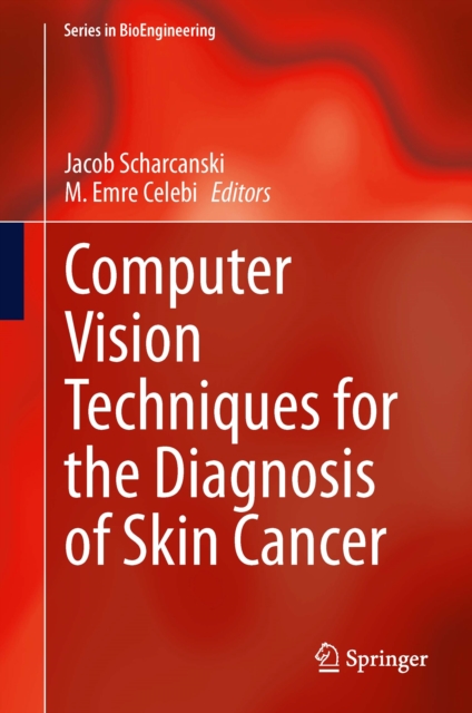 Computer Vision Techniques for the Diagnosis of Skin Cancer, PDF eBook