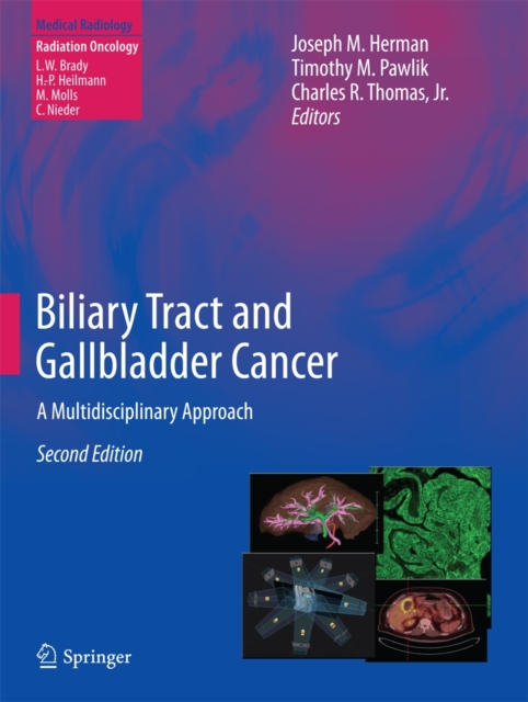 Biliary Tract and Gallbladder Cancer : A Multidisciplinary Approach, Hardback Book