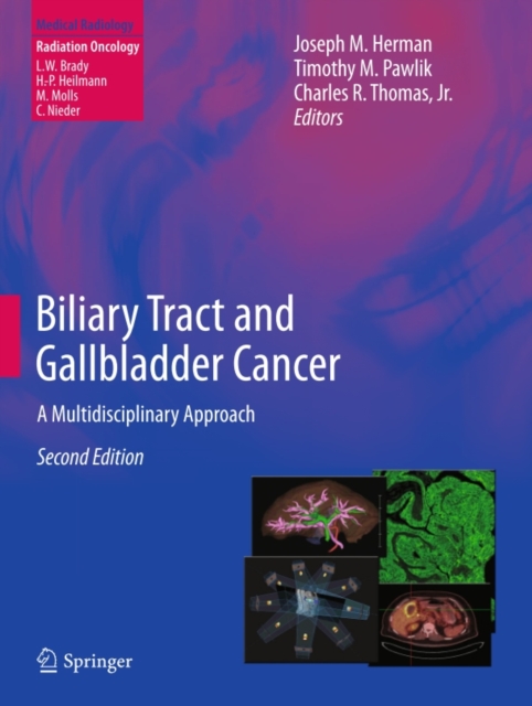 Biliary Tract and Gallbladder Cancer : A Multidisciplinary Approach, PDF eBook