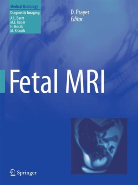 Fetal MRI, Paperback / softback Book