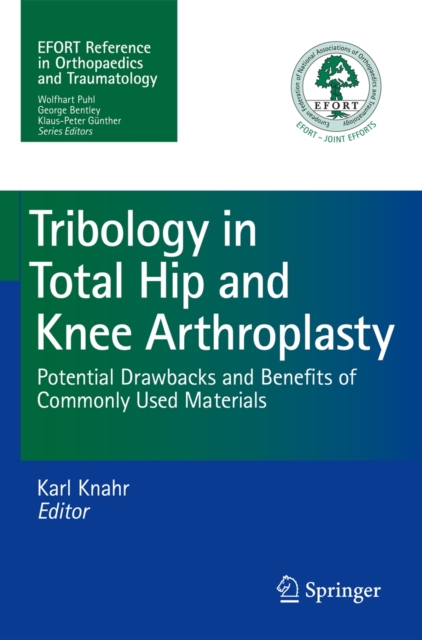 Tribology in Total Hip and Knee Arthroplasty : Potential Drawbacks and Benefits of Commonly Used Materials, Paperback / softback Book