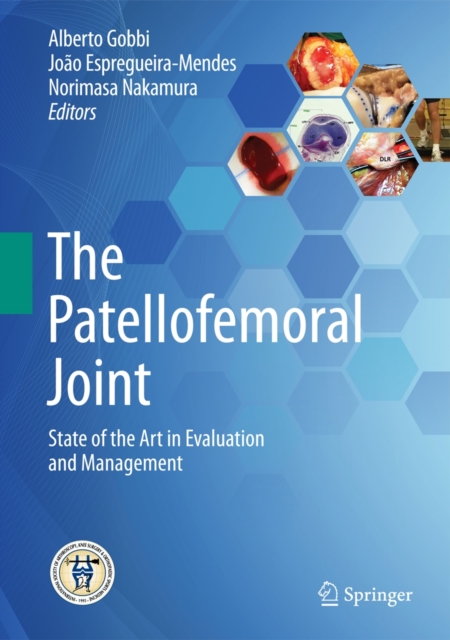 The Patellofemoral Joint : State of the Art in Evaluation and Management, Hardback Book
