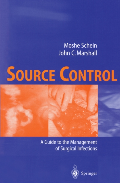 Source Control : A Guide to the Management of Surgical Infections, PDF eBook