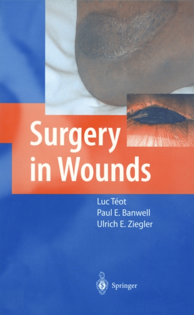 Surgery in Wounds, PDF eBook