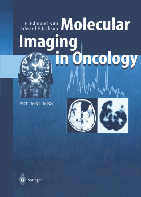 Molecular Imaging in Oncology : PET, MRI, and MRS, PDF eBook
