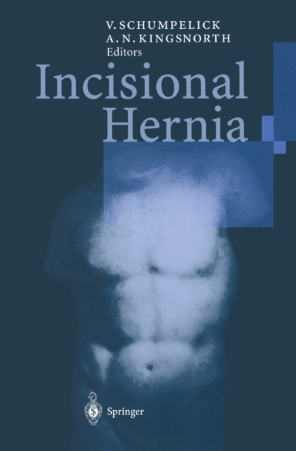 Incisional Hernia, PDF eBook
