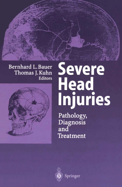 Severe Head Injuries : Pathology, Diagnosis and Treatment, PDF eBook