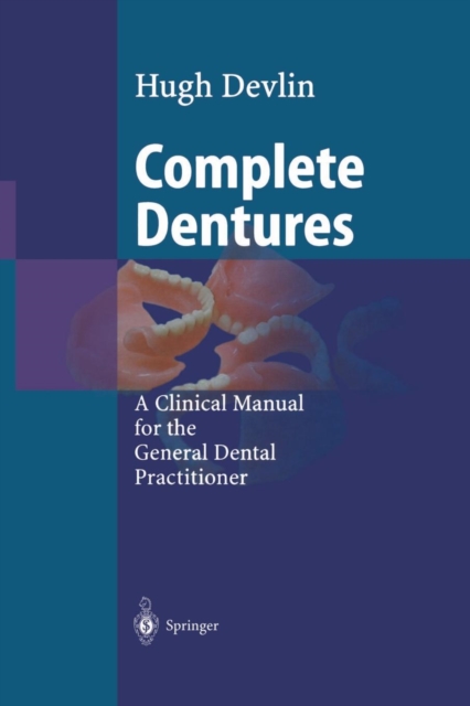 Complete Dentures, Paperback / softback Book