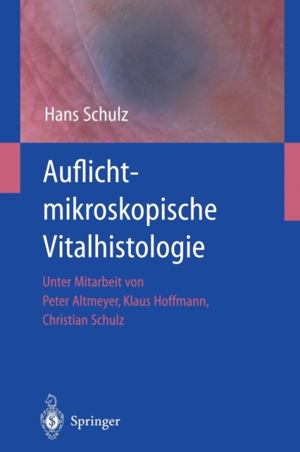 Auflichtmikroskopische Vitalhistologie : Dermatologischer Leitfaden, Paperback / softback Book