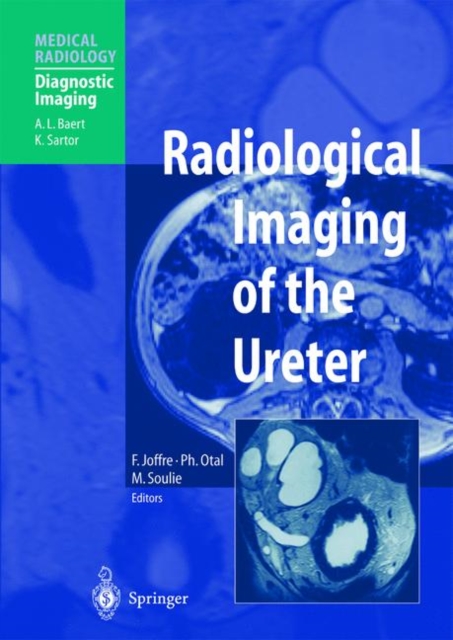Radiological Imaging of the Ureter, Paperback / softback Book