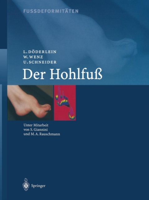 Fussdeformitaten : Der Hohlfuss, Paperback / softback Book