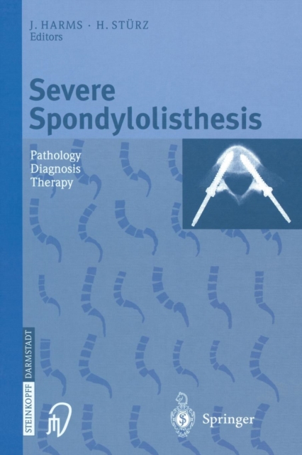 Severe Spondylolisthesis : Pathology - Diagnosis - Therapy, Paperback / softback Book