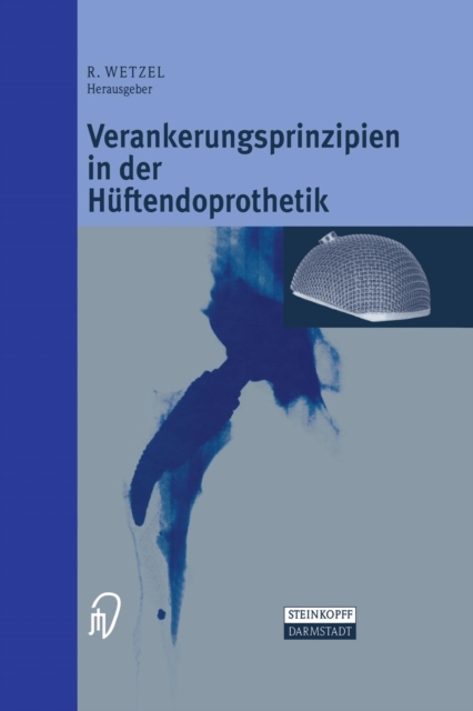 Verankerungsprinzipien in Der Huftendoprothetik, Paperback / softback Book