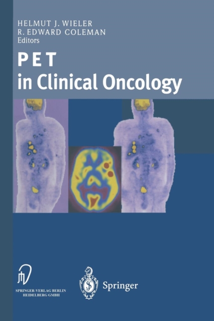 PET in Clinical Oncology, Paperback / softback Book