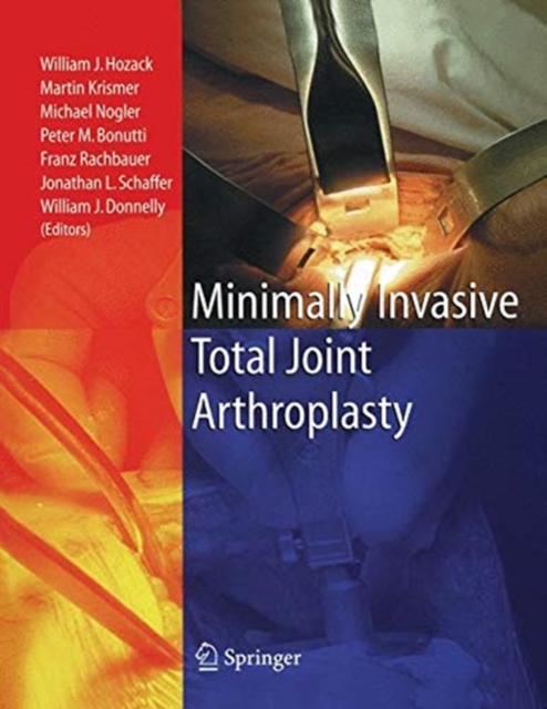 Minimally Invasive Total Joint Arthroplasty, Paperback / softback Book