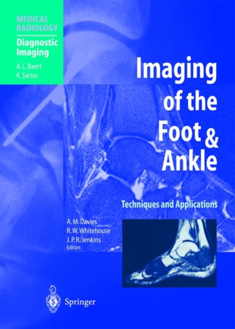Imaging of the Foot & Ankle : Techniques and Applications, Paperback / softback Book