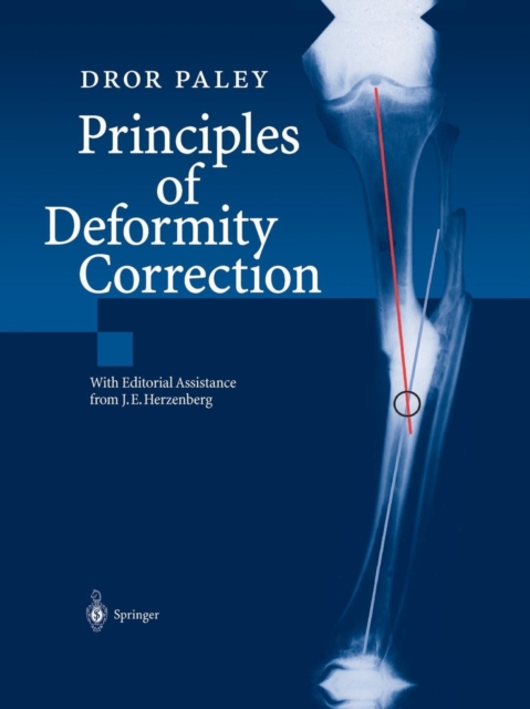 Principles of Deformity Correction, Paperback / softback Book