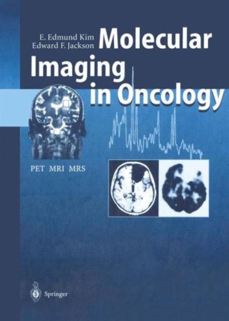Molecular Imaging in Oncology : PET, MRI, and MRS, Paperback / softback Book