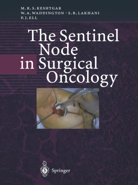 The Sentinel Node in Surgical Oncology, Paperback / softback Book