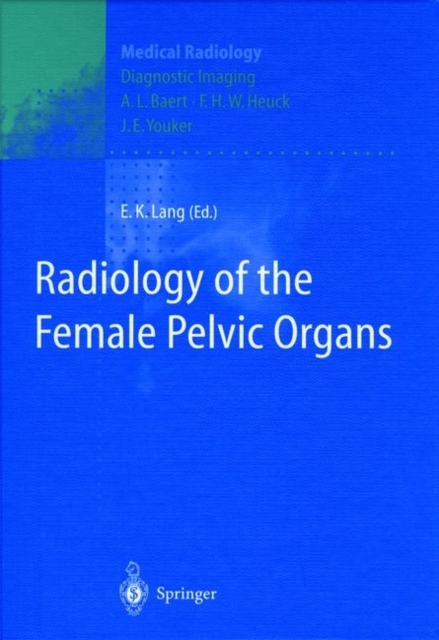 Radiology of the Female Pelvic Organs, Paperback / softback Book