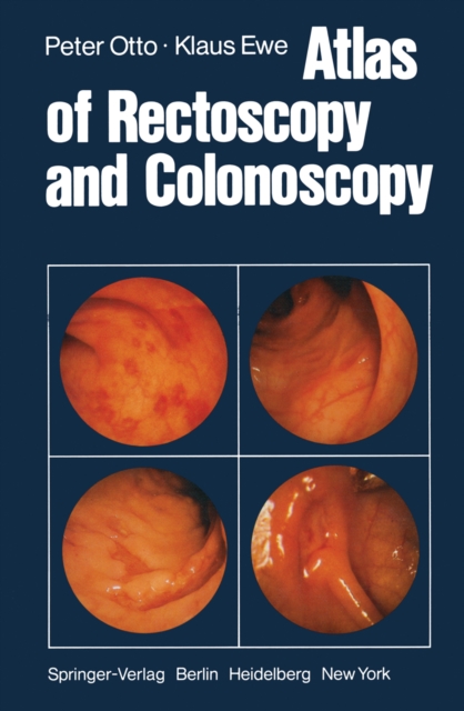 Atlas of Rectoscopy and Coloscopy, PDF eBook