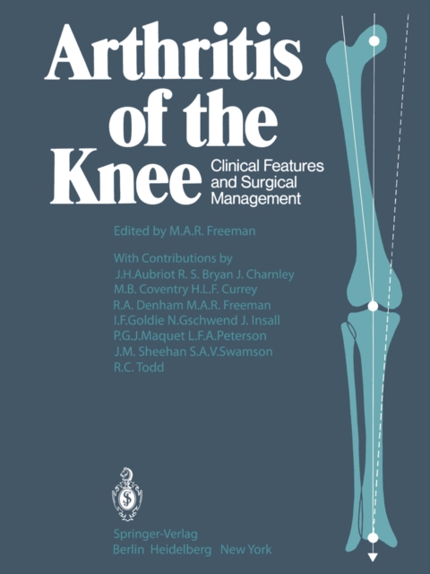 Arthritis of the Knee : Clinical Features and Surgical Management, PDF eBook