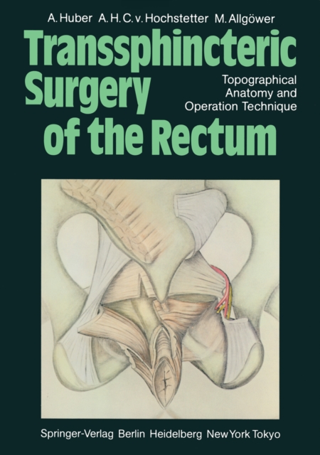 Transsphincteric Surgery of the Rectum : Topographical Anatomy and Operation Technique, PDF eBook