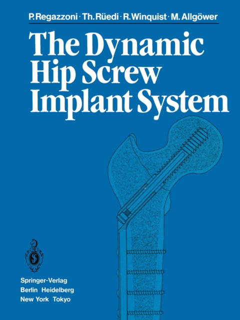The Dynamic Hip Screw Implant System, PDF eBook