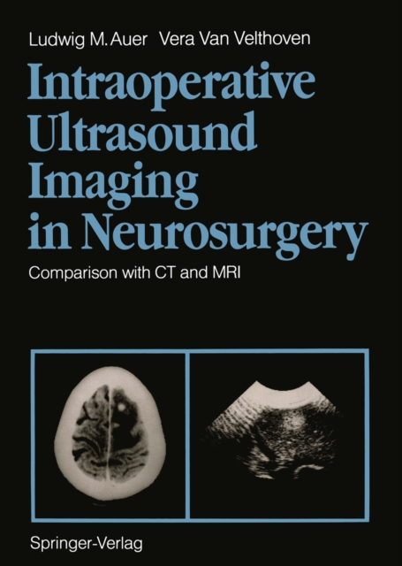 Intraoperative Ultrasound Imaging in Neurosurgery : Comparison with CT and MRI, PDF eBook