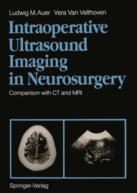 Intraoperative Ultrasound Imaging in Neurosurgery : Comparison with CT and MRI, Paperback / softback Book