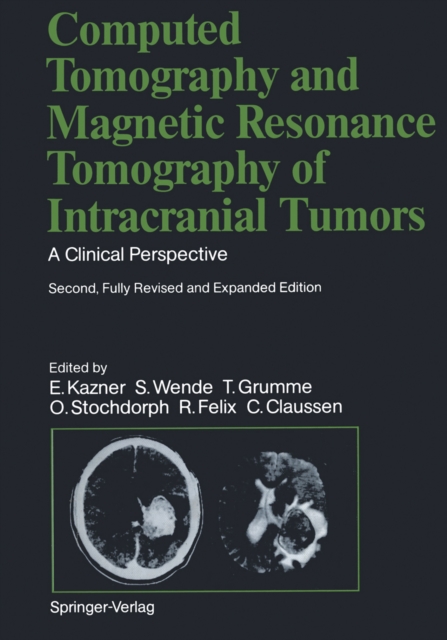 Computed Tomography and Magnetic Resonance Tomography of Intracranial Tumors : A Clinical Perspective, PDF eBook