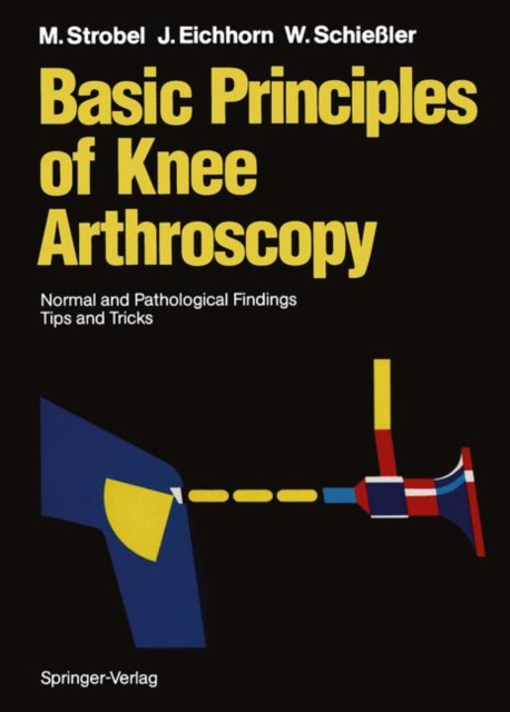 Basic Principles of Knee Arthroscopy : Normal and Pathological Findings Tips and Tricks, Paperback / softback Book