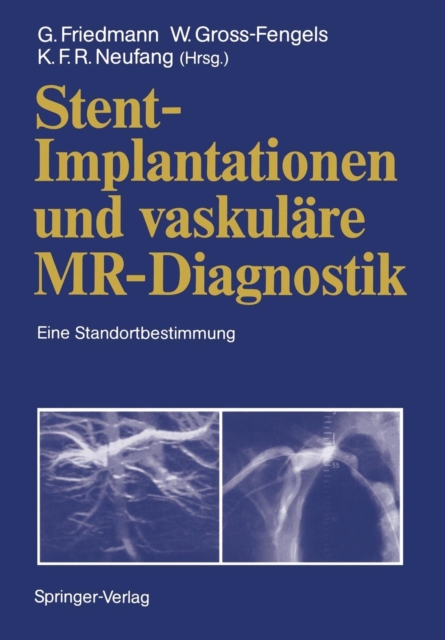 Stent-Implantationen und Vaskulare MR-Diagnostik, Paperback / softback Book