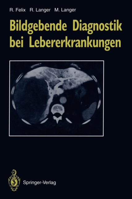 Bildgebende Diagnostik bei Lebererkrankungen, Paperback / softback Book