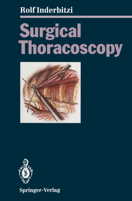 Surgical Thoracoscopy, PDF eBook