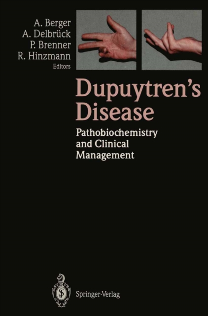 Dupuytren's Disease : Pathobiochemistry and Clinical Management, PDF eBook