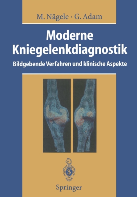 Moderne Kniegelenkdiagnostik, Paperback / softback Book