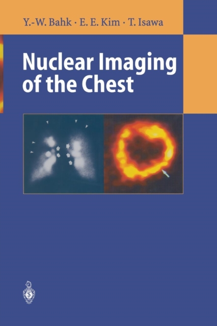 Nuclear Imaging of the Chest, Paperback / softback Book