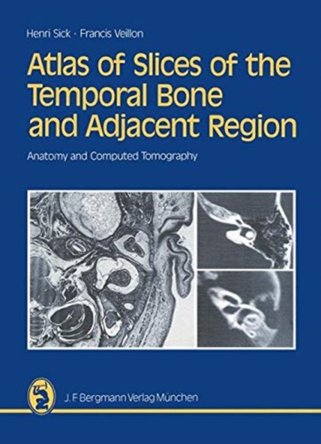 Atlas of Slices of the Temporal Bone and Adjacent Region : Anatomy and Computed Tomography Horizontal, Frontal, Sagittal Sections, Paperback / softback Book