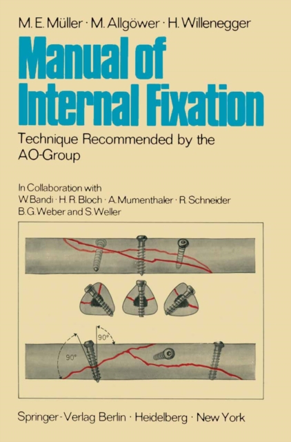 Manual of Internal Fixation : Technique Recommended by the AO-Group Swiss Association for the Study of Internal Fixation: ASIF, PDF eBook