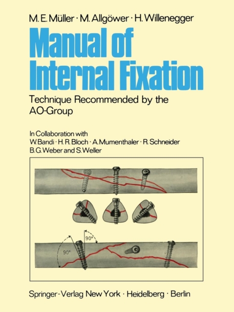 Manual of Internal Fixation : Technique Recommended by the AO-Group Swiss Association for the Study of Internal Fixation: ASIF, Paperback / softback Book