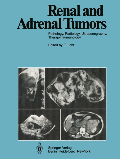 Renal and Adrenal Tumors : Pathology, Radiology, Ultrasonography, Therapy, Immunology, PDF eBook