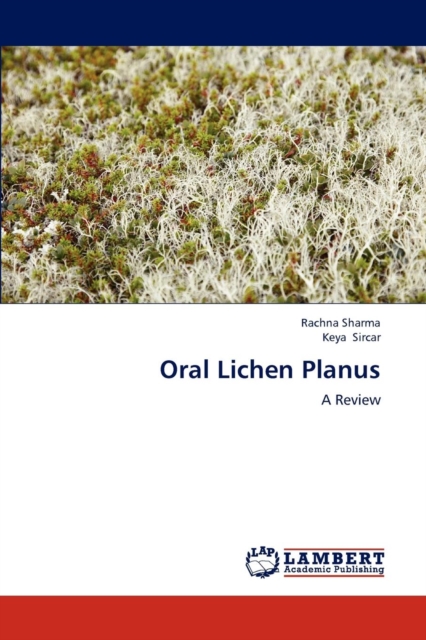 Oral Lichen Planus, Paperback / softback Book